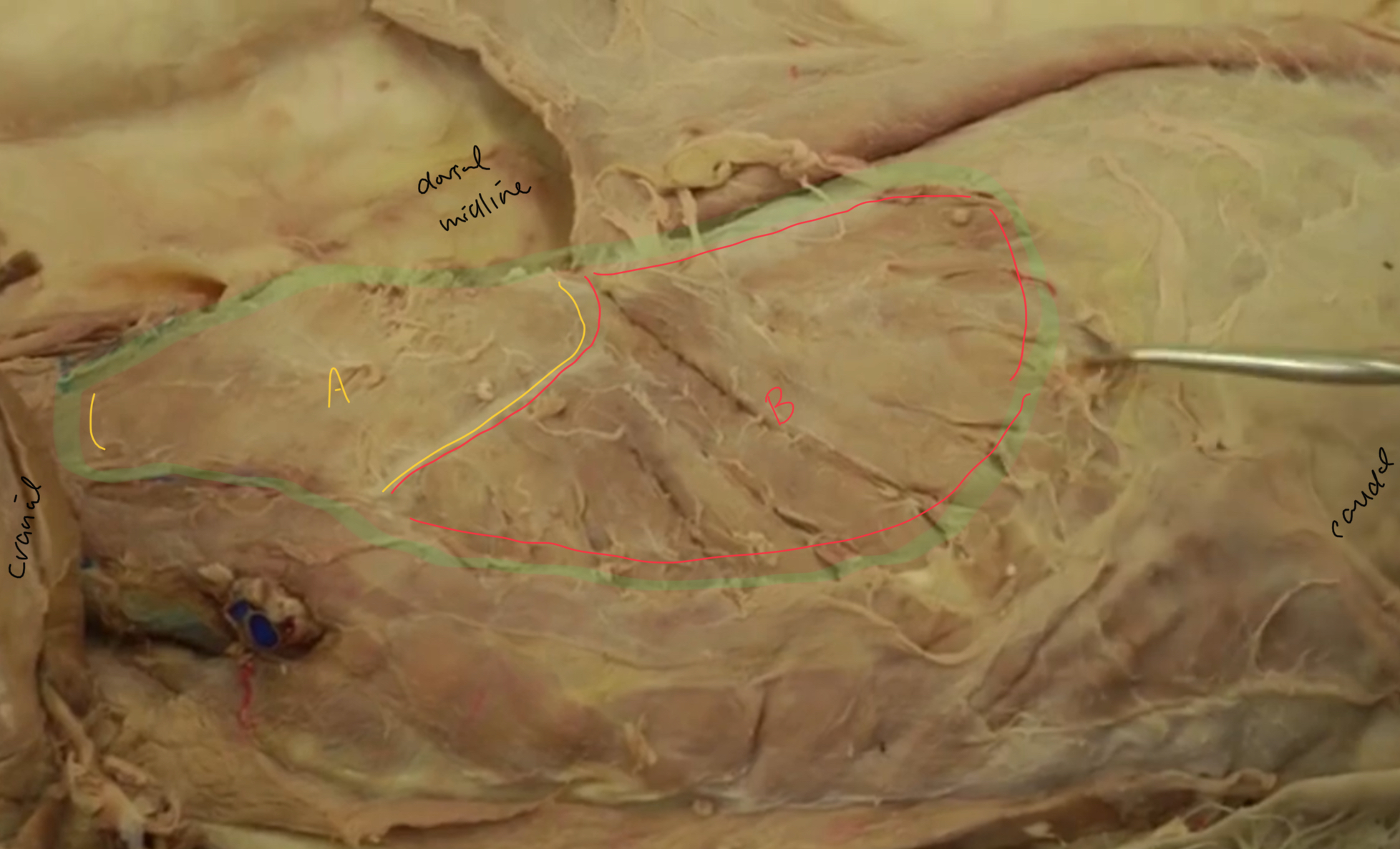 <p>what is yellow A?</p>