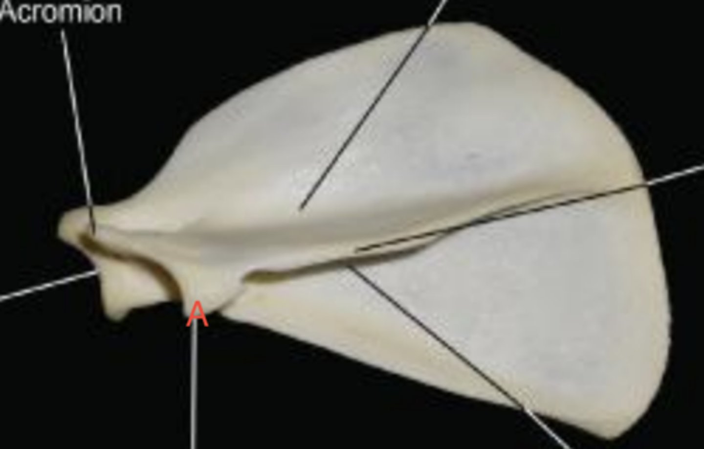 <p>What structure is labeled as A in this picture?</p>