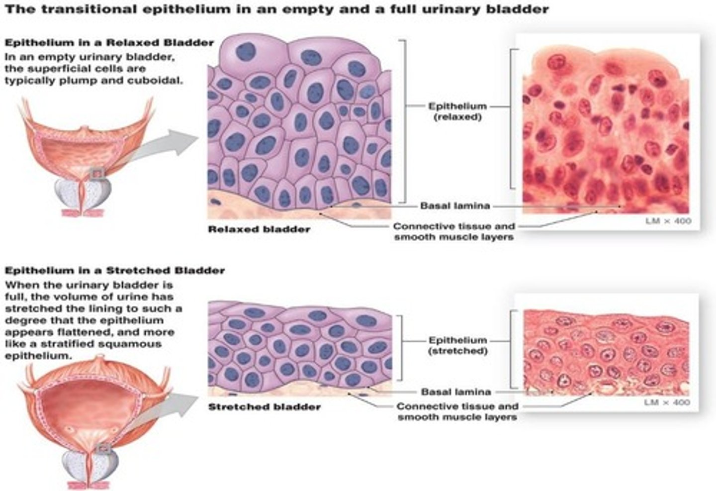 <p>a type of epithelial tissue that can change shape when stretched, found only in the urinary system.</p>