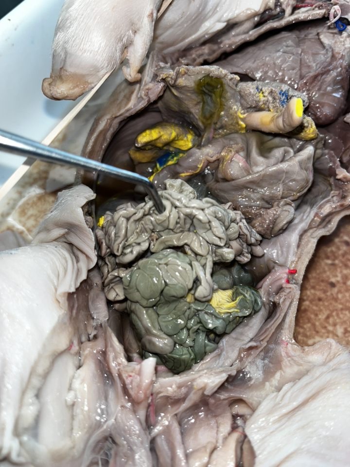 <p>What region of the small intestine is shown?</p>
