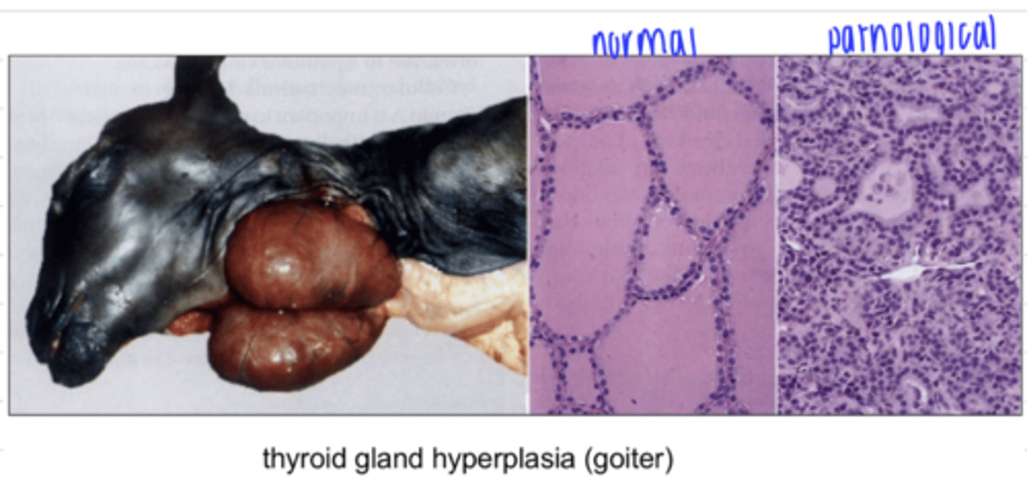 <p>hyperplasia</p>
