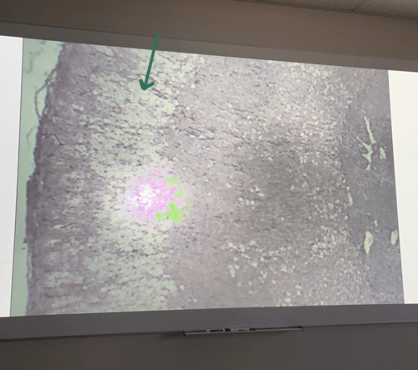 <p>gland and structure</p>