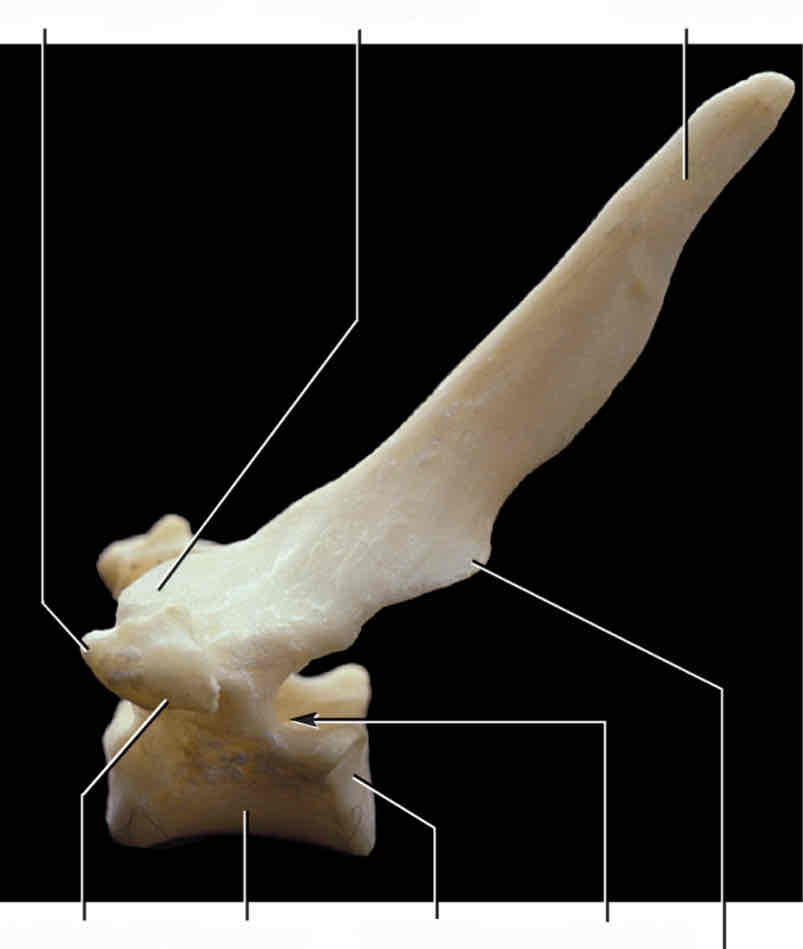 <p>What type of vertebra is this? How can you tell?</p>