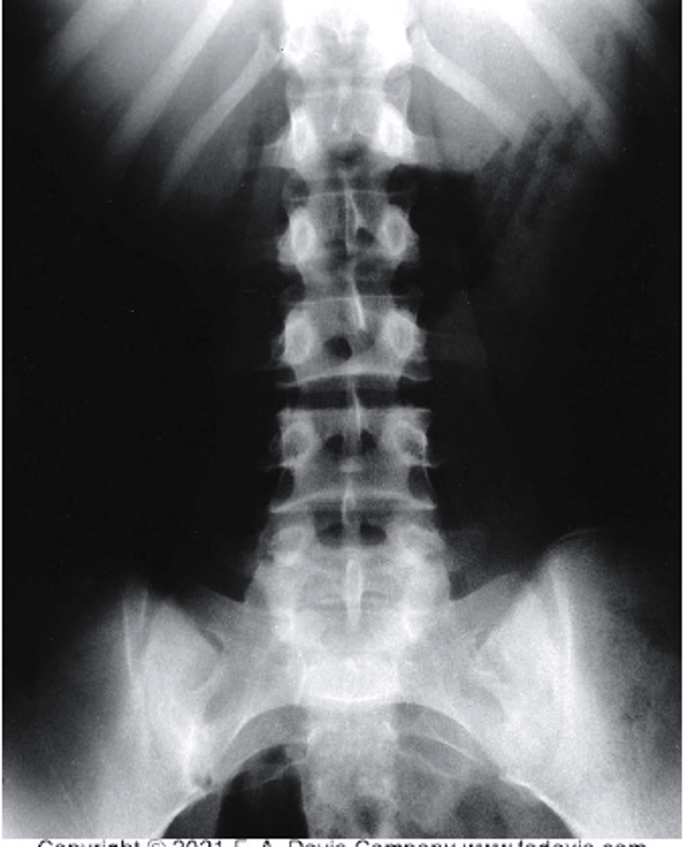 <p>This is an example of a _______.</p><p>a. view</p><p>b. projection</p><p>c. conventional MRI</p><p>d. none of these</p>
