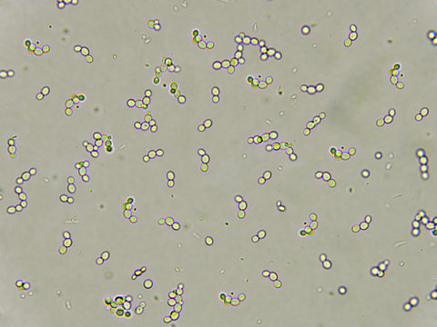 <p>name this cell? What is it associated with?</p>