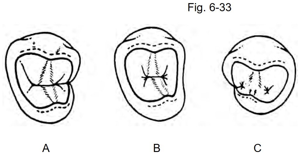 <p>Identify C in Fig 6-33</p><p>a. #20</p><p>b. #19</p><p>c. #27</p><p>d. #28</p><p>e. #29</p>