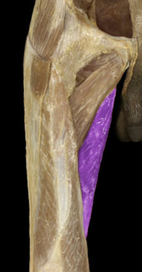 <p>What is/are this muscle’s insertion(s)?</p>