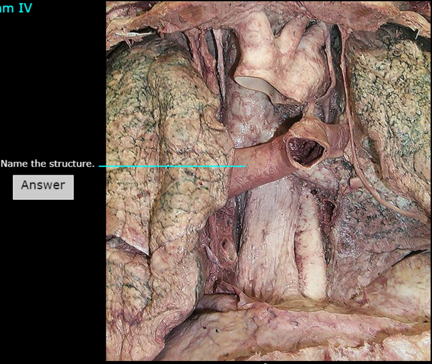 <p>What artery is this</p>