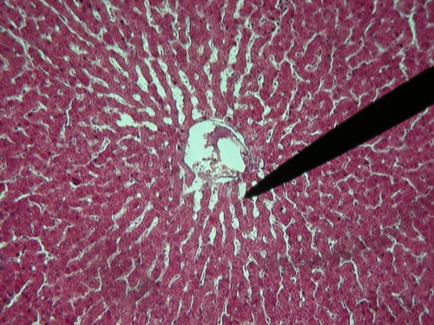 <p>Small blood vessels in the liver that allow for exchange between blood and liver cells.</p>