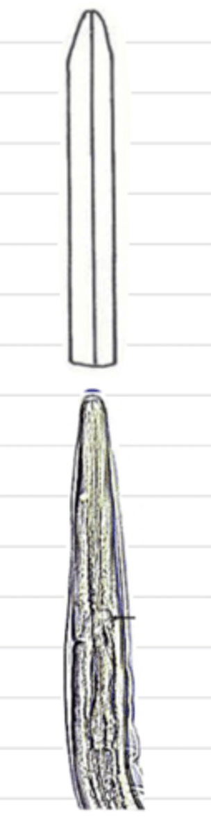 <p>what type of esophagus is this?</p>