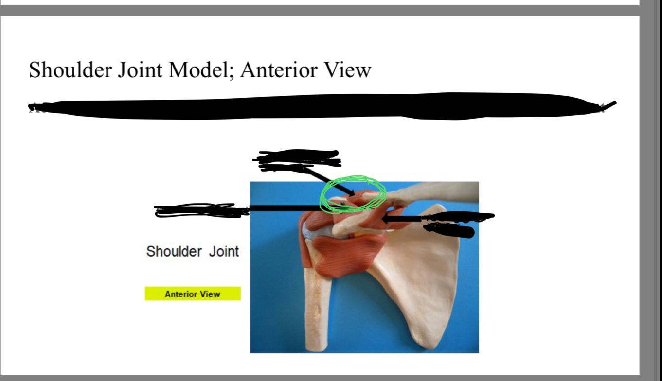 <p>Acromioclavicular ligament</p>