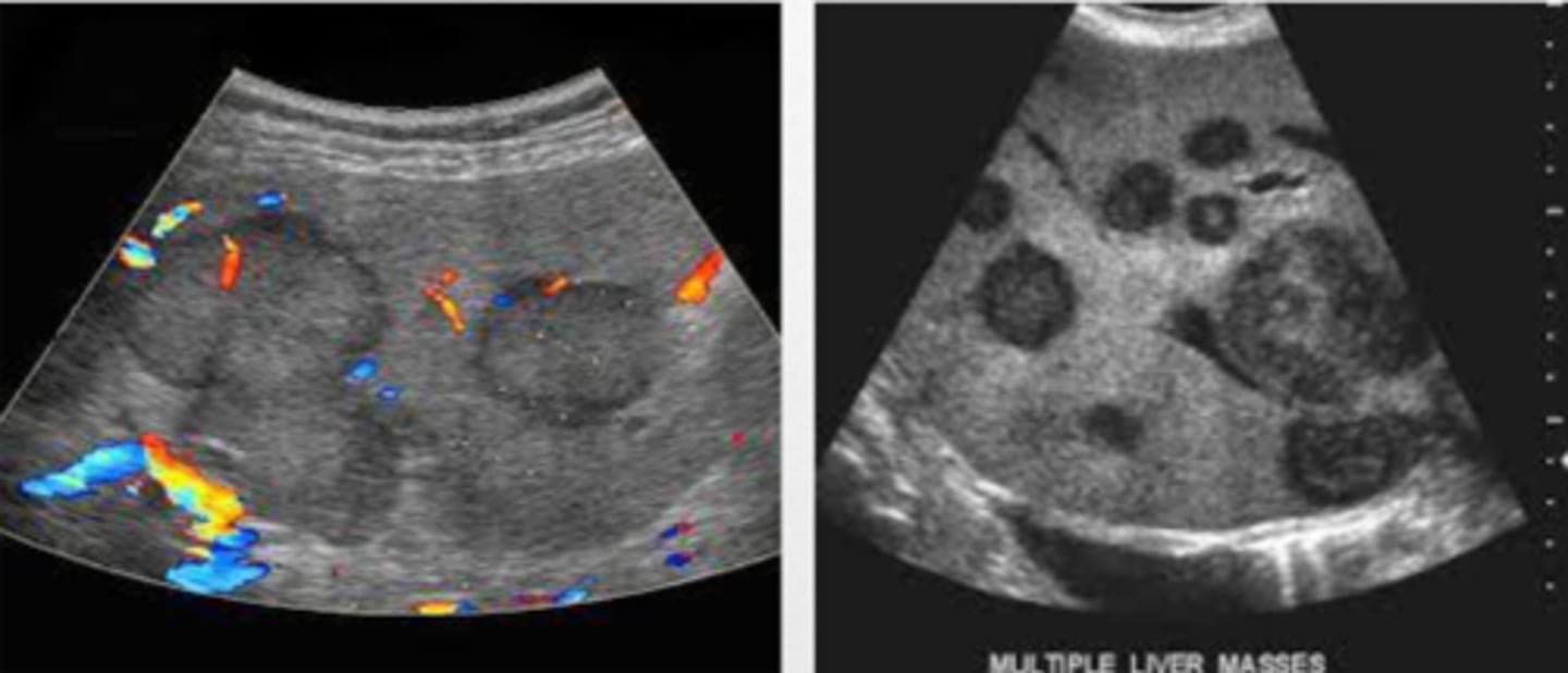<p>liver</p>