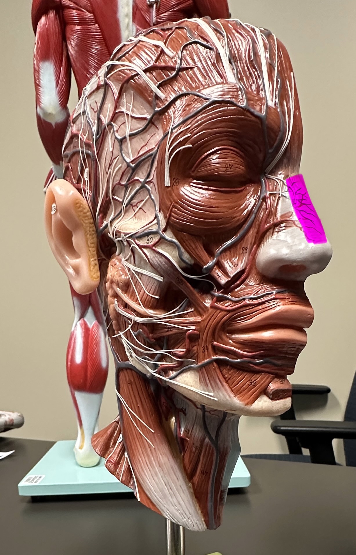 <p>What is the highlighted structure</p>