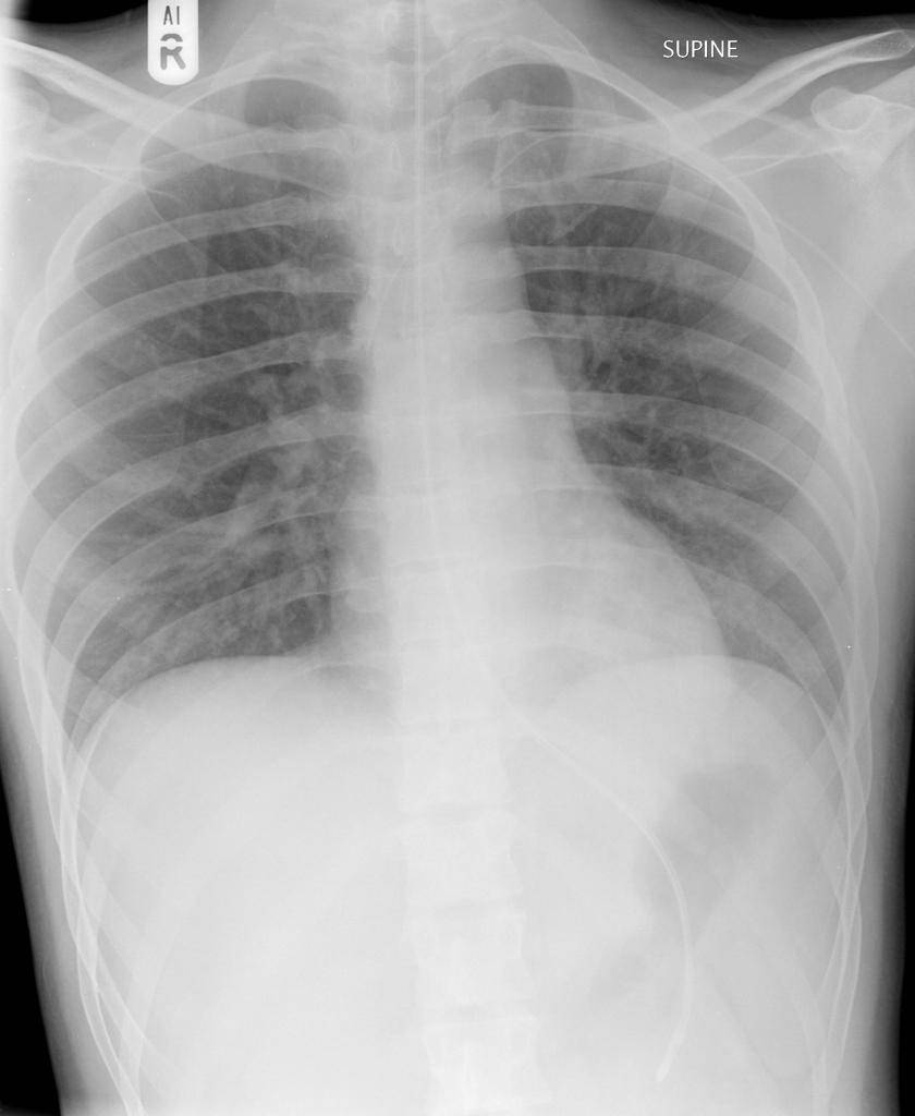 <p>It should be parallel to the spine, curve into the stomach, and end with the weighted tip angled downward.</p>