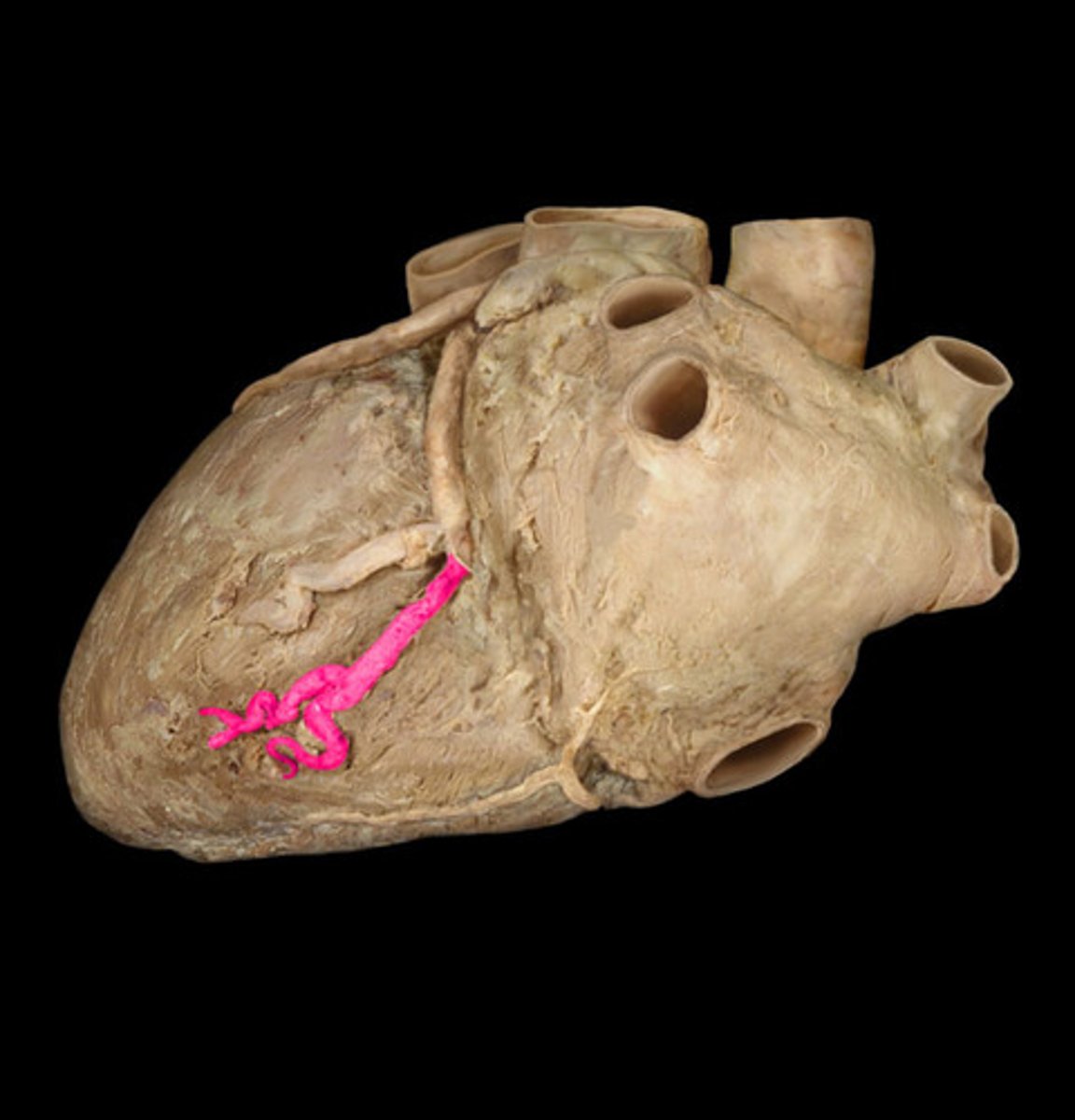 <p>in the posterior interventricular sulcus</p>