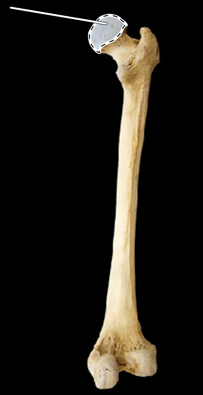 <p>Name the highlighted portion.</p><p>(Femur, posterior view, right side).</p>