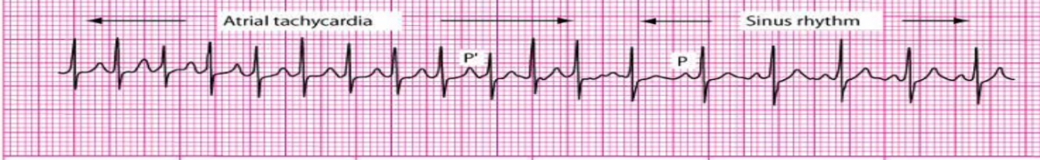 <p>What’s the rhythm?</p>