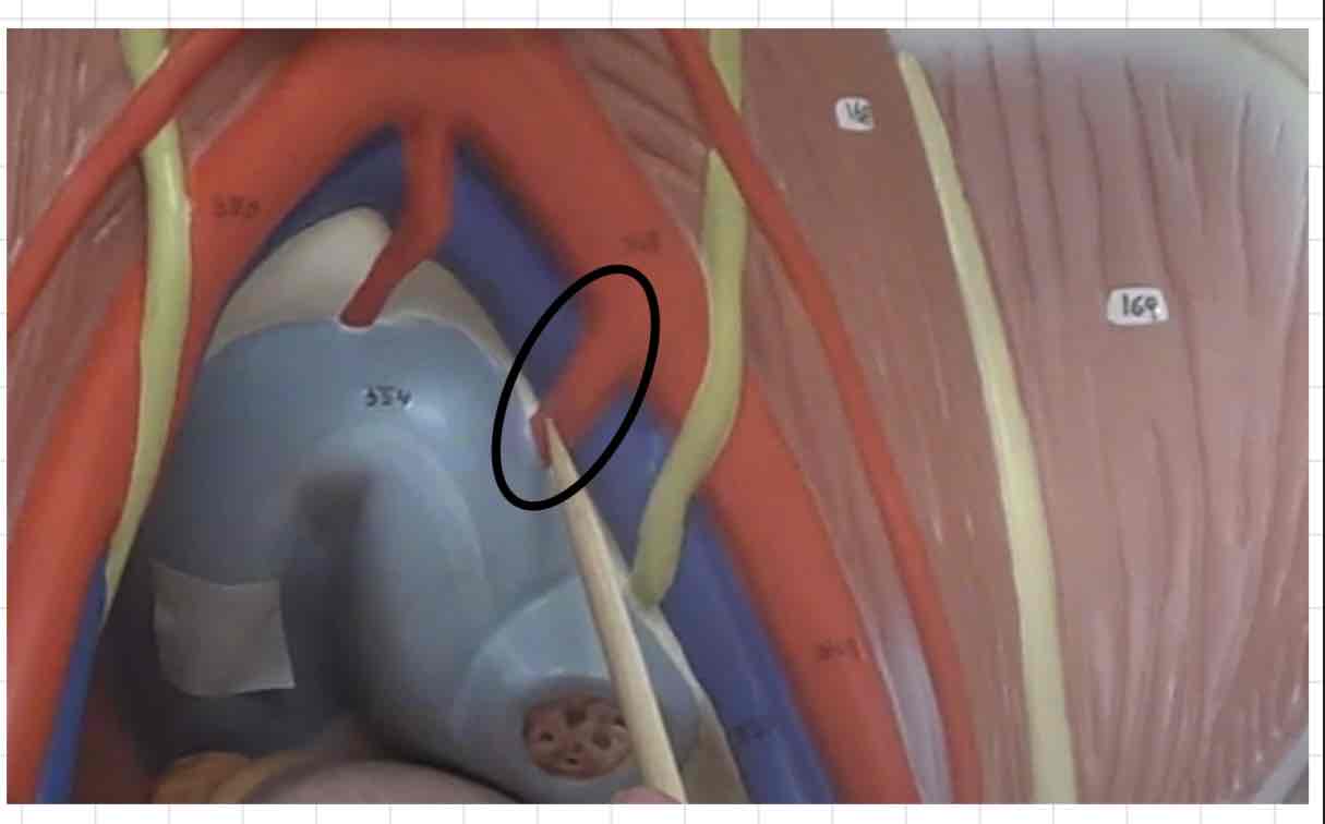 <p>what is this? (torso model)</p>