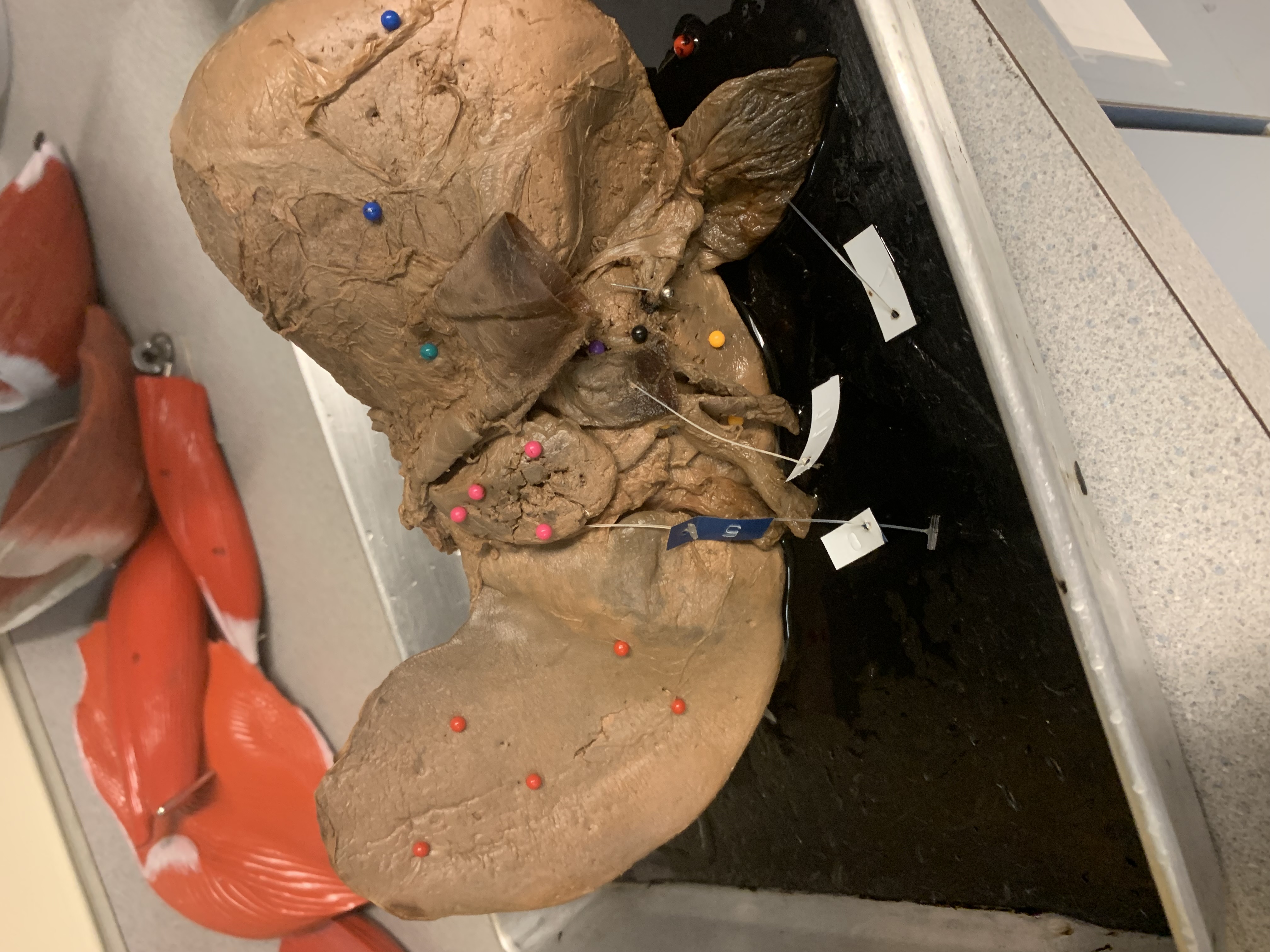 <p>dark green pins</p>