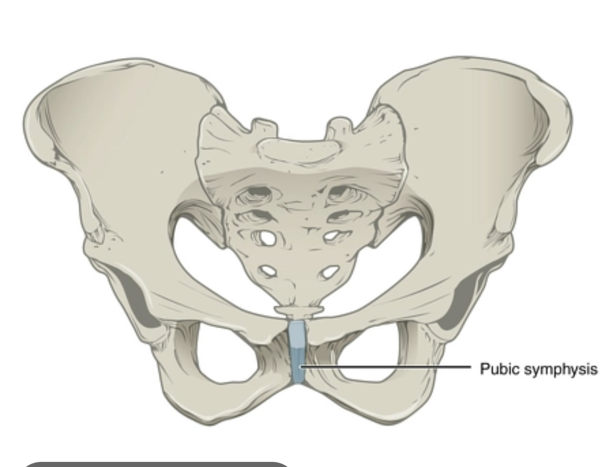 Two bones have grown closely together limiting movement forming an immovable joint 