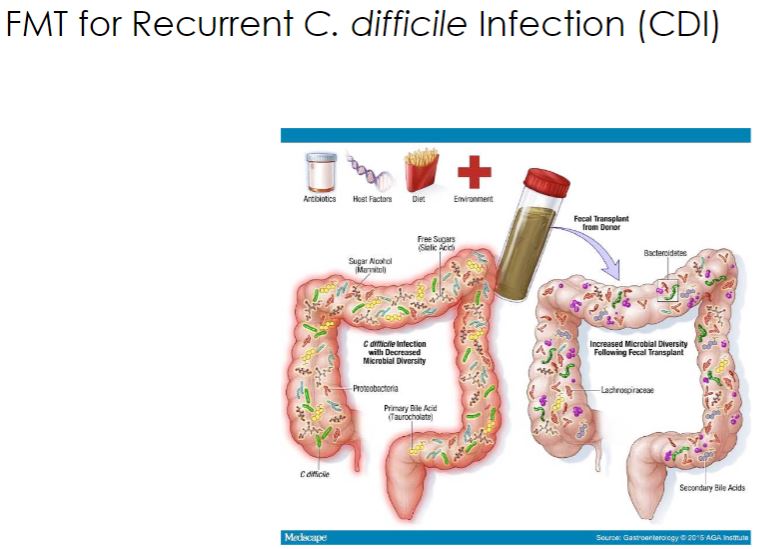 <p>-Another confounding factor has been that until recently it has been difficult to evaluate whether probiotic bacteria actually colonize the gut or are retained long enough to have an effect. The discovery that many so-called probiotic microorganisms do not effectively colonize the intestines has led to the development of symbiotics. Synbiotics are foods or supplements that include both a prebiotic and a probiotic. The prebiotic is a compound(s) added to enhance the colonization and positive health benefits of probiotic microbes. Although it is much harder to control the uniformity and effectiveness of a product that contains microbes than a drug with a unique chemical structure, the recognition that the microbiome is, in essence, a newly discovered organ needed for human homeostasis is propelling the unstoppable development of probiotics for preventative medicine. It is likely that hospitalized patients will routinely be given an oral dose of a synbiotic to protect against the development of infection with antibiotic-resistant pathogens. Similarly, outpatients requiring antibiotic therapy may also be prescribed a probiotic cocktail for microbiome reconstitution following treatment. Tourists may soon be packing probiotics to prevent travelers&apos; diarrhea along with their sunscreen and flip-flops.</p><p>Until researchers, pharmaceutical companies, and regulatory agencies synchronize their approach to probiotics, it is instructive to consider the successful use of probiotics in animals. For example, Lactobacillus acidophilus is used in beef cattle feed. When these bacteria are sprayed on feed, cattle appear to have markedly lower (as much as 60%) carriage of the pathogenic E. coli strain O157:H7. This can make it easier to produce beef that meets current standards for microbiological quality at the time of slaughter. Probiotics are also used successfully with poultry. For instance, Salmonella enterica can be controlled by spraying a patented blend of 29 bacteria, isolated from the chicken cecum, on day-old chickens. As they preen themselves, the chicks ingest the bacterial mixture, establishing a functional microbiome that limits Salmonella colonization of the gut. In an age of increasing antimicrobial resistance, the use of probiotics may prove to be valuable for both humans and the animals they consume.</p>