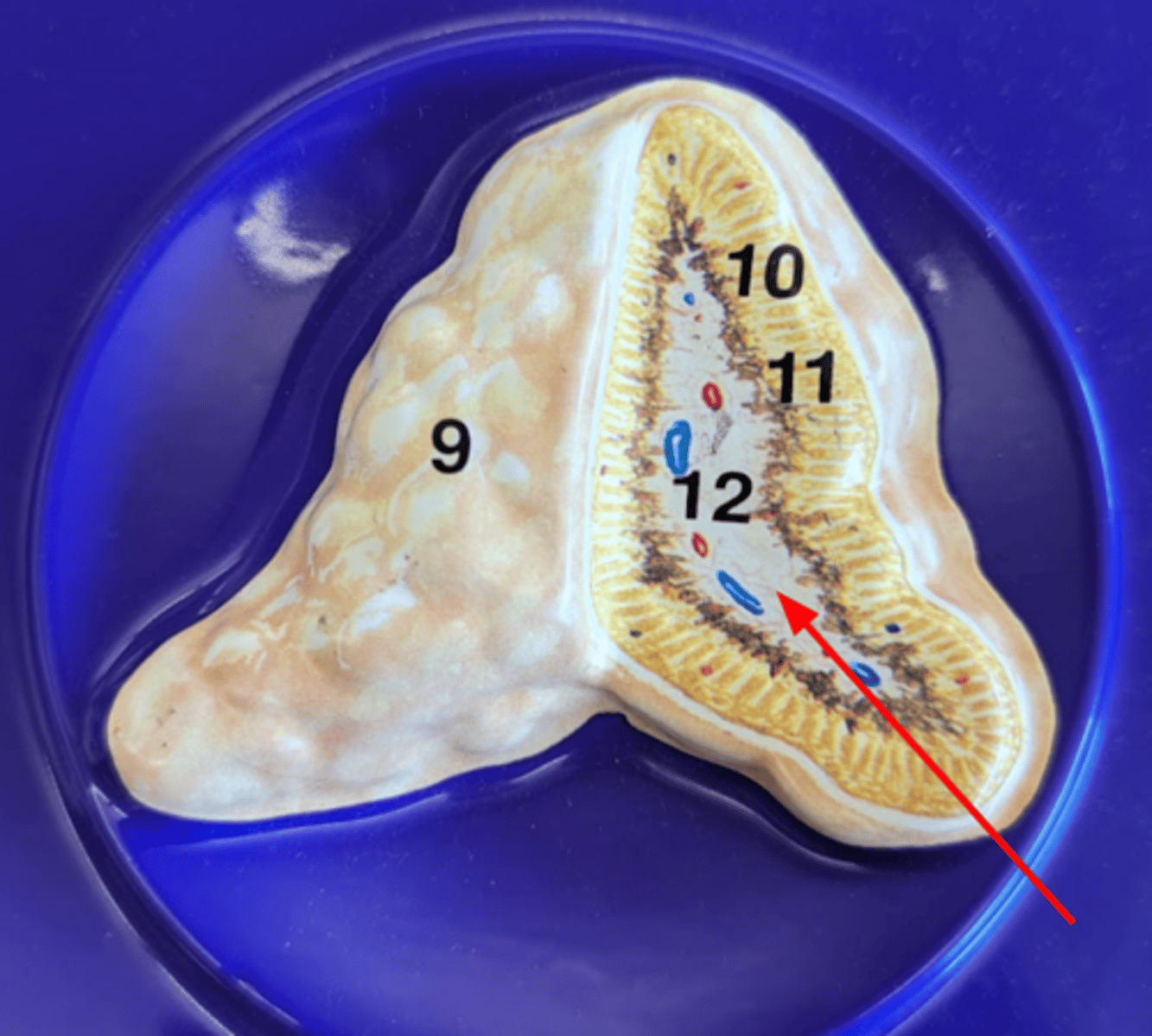 <p>Name this gland</p>