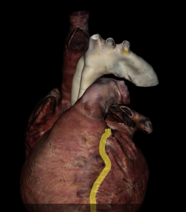 <p>What is highlighted in yellow?</p>