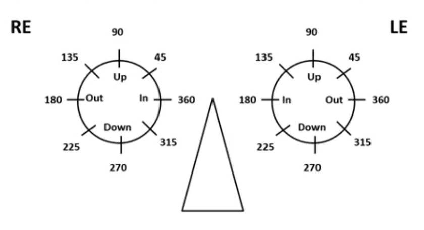 <p>triangle should be patients nose </p><p>base ou tin the RE would have an axis notation of 180 degrees, and base out for the ledt eye would be 360 degrees </p>