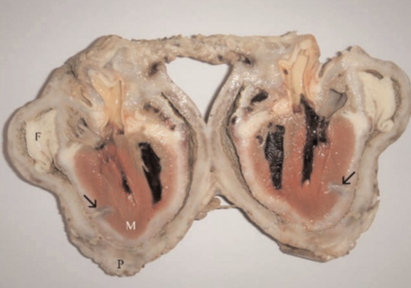 <p>Morphologic diagnosis?</p>