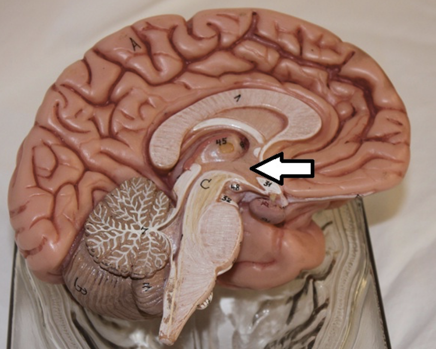 <p>identify this part of the brain</p>