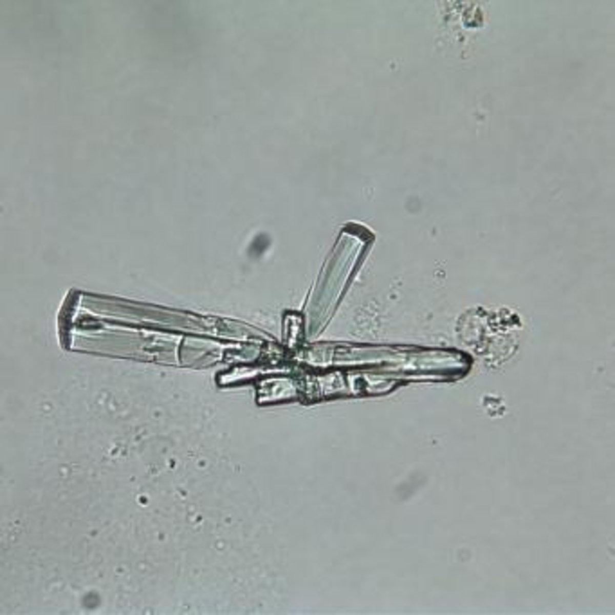 <p>Radiographic contrast media, Ampicillin crystals, and Sulfa crystals.</p>