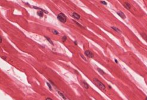 <ul><li><p>muscle of the heart</p></li><li><p>involuntary control, pumps the blood</p></li><li><p>cylindrical cells, shorter than skeletal muscle cells</p></li><li><p>striated, 1 nucleus per cell</p></li></ul><p></p>