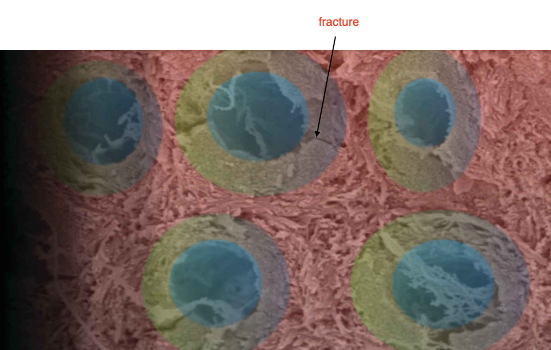 <p>1) dentinal tubules: holes from DEJ to pulps (blue)</p><p>2) peritubular dentin: around tubule, very calcified area (green)</p><p>3) intertubular dentin: dentin between each tube (red area) </p>
