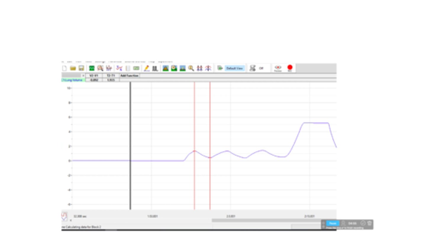 <p>What volume is shown on this spirometer tracing?</p>