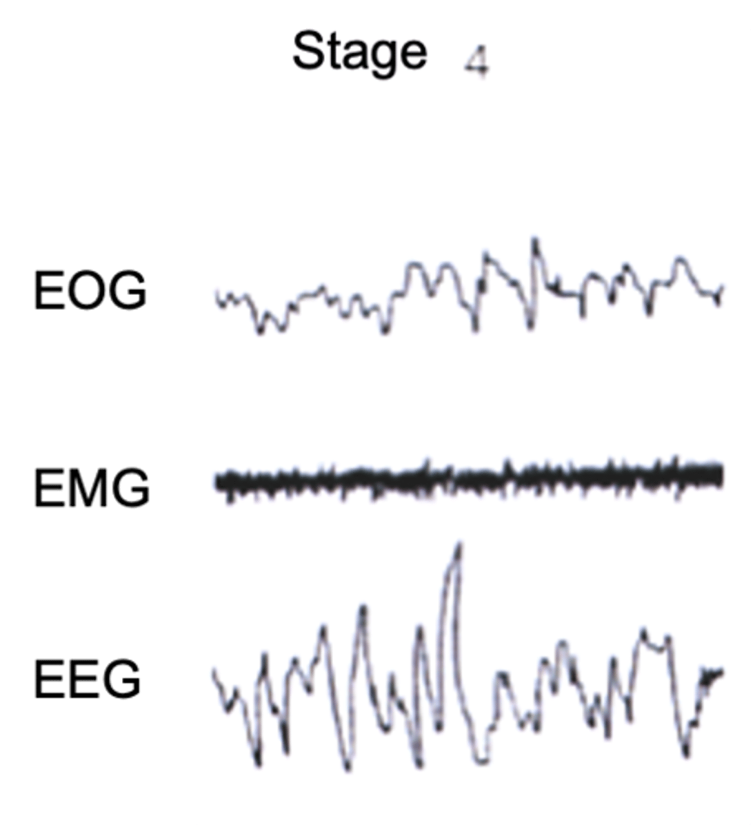 <p>______ wave activity _________ and dominates the EEG record</p>