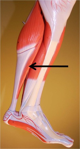 <p>plantar flexes foot</p>