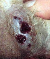 <p><span>Bacterial Pseudomycetoma (Botryomycosis)</span></p>