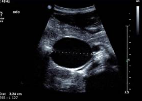 term image
