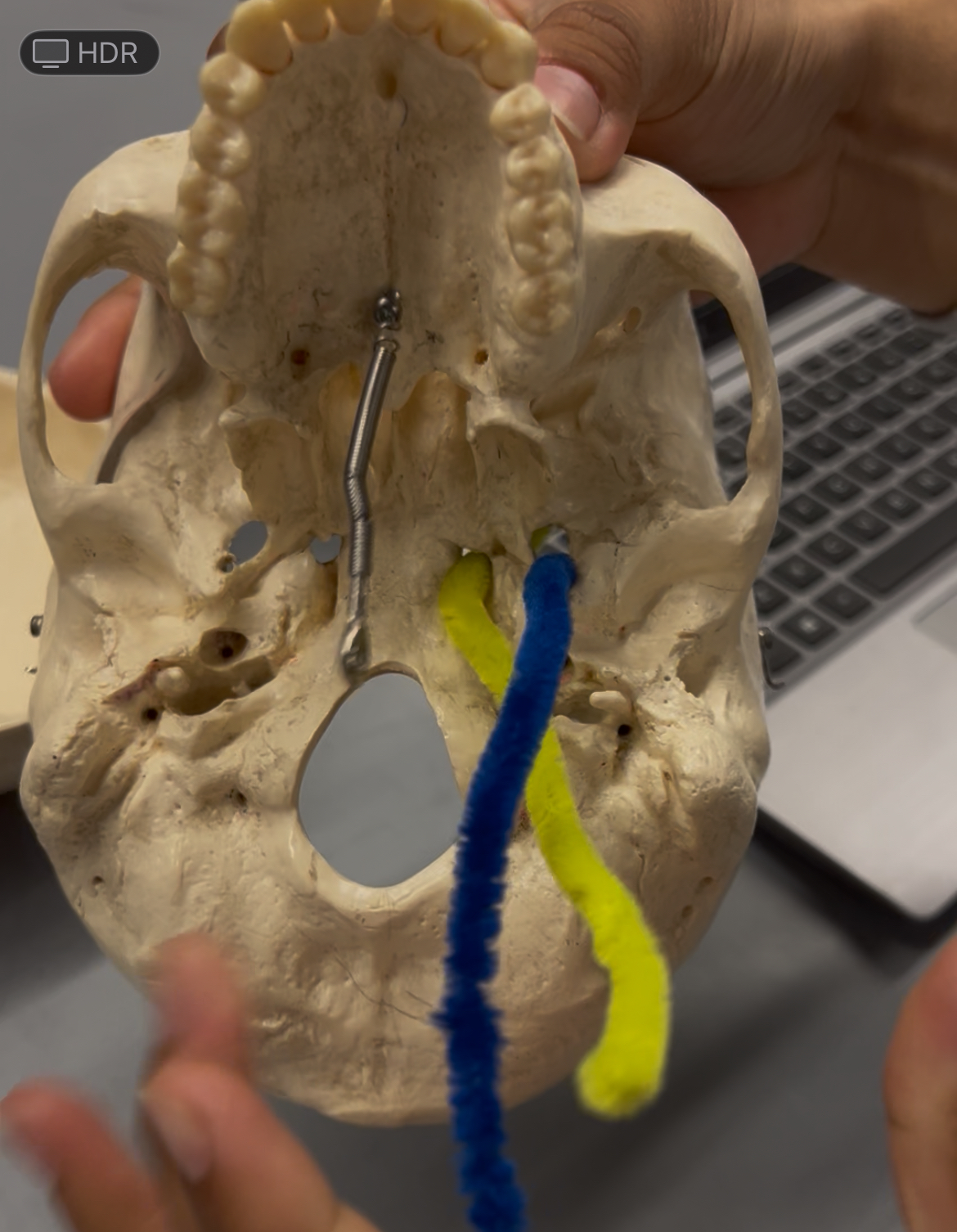 <p>What foramina is labeled by the blue and yellow pipes? What bones are the located? Also, which if any cranial nerves pass through there?</p>