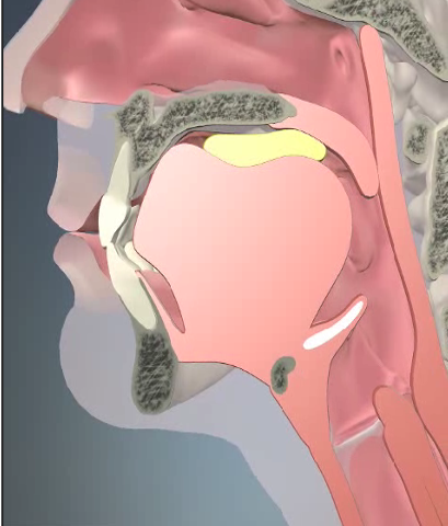 <p>Voluntary control </p><p>The initiation of this phase of swallowing is marked by tongue movement that results in posterior transport of the bolus into the pharyngeal cavity </p><p>It begins with the tip of the tongue is placed at the alveolar ridge </p><p>Respiration ceases during this phase of swallowing to maintain adequate airway protection </p><p>Soft palate is elevated </p><p>Tongue is depressed and pulled backward </p><p>The anterior portion of the tongue is elevated to the hard palate and squeezes the bolus backward </p>