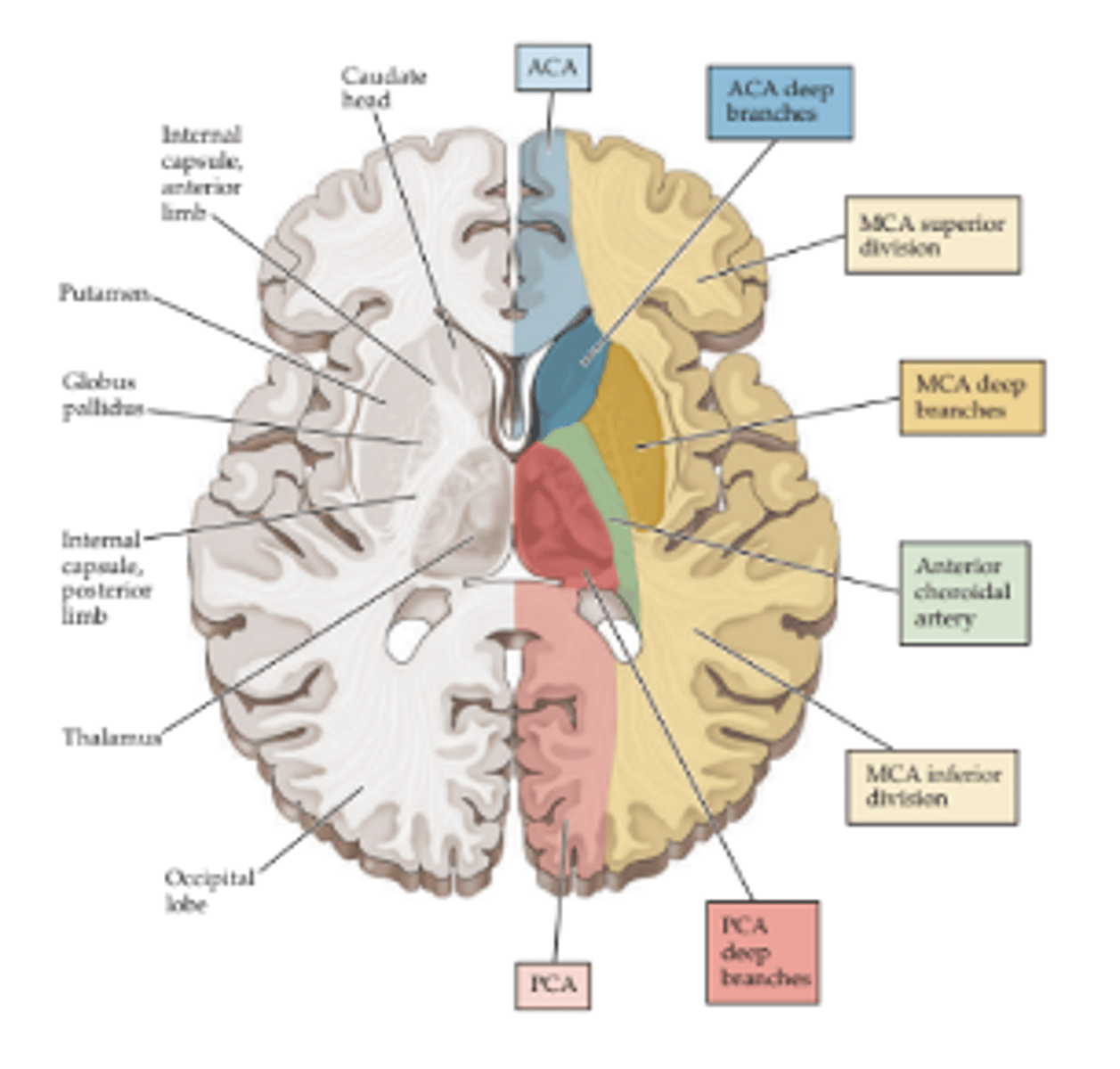 <p>➢Right facial droop</p><p>➢Right upper > lower extremity weakness</p><p>➢Right hemisensory loss</p><p>➢Right hemianopia</p><p>➢LEFT gaze preference</p><p>➢Expressive vs Receptive Aphasia (language)</p>