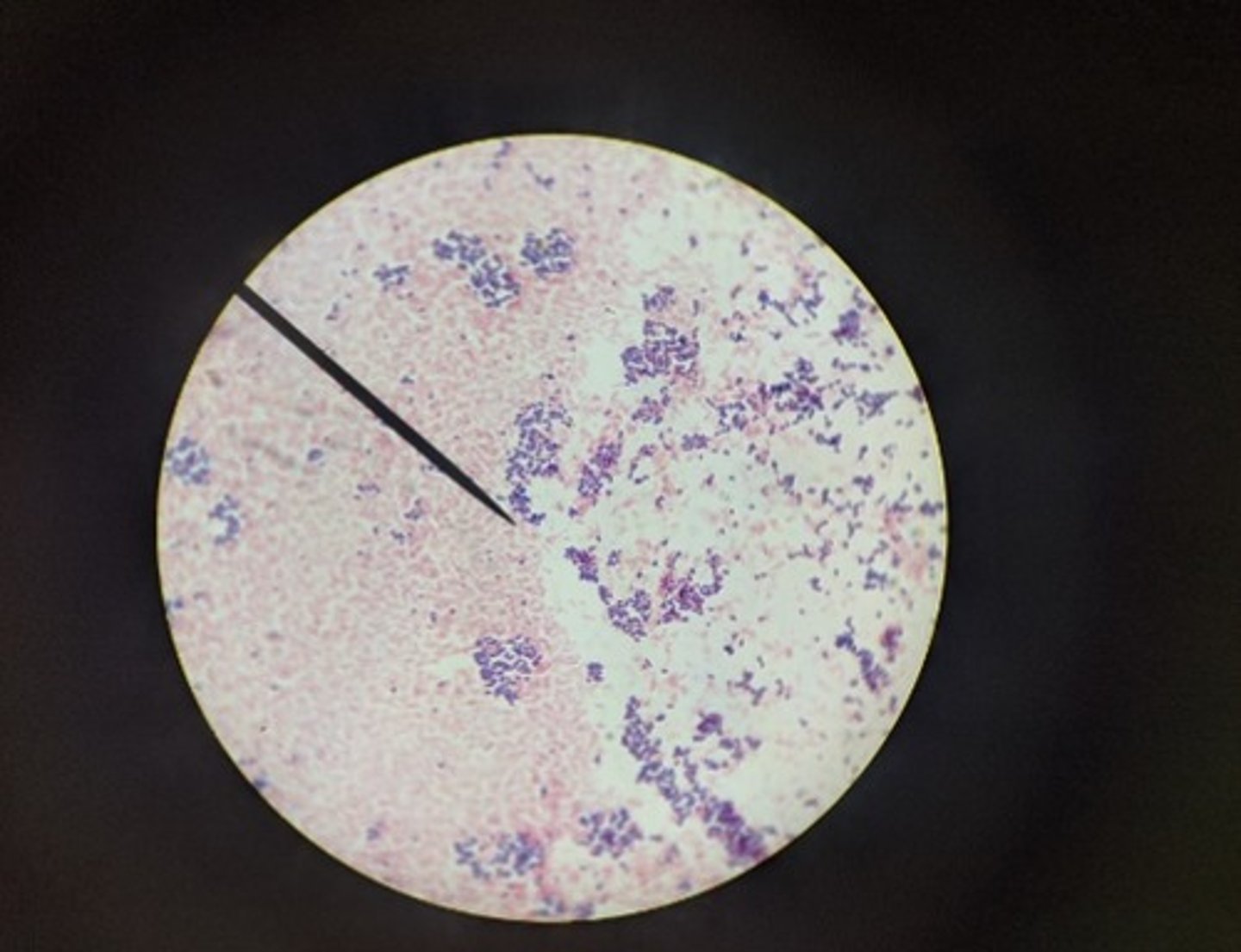<p>E. coli = Gram-negative rods; S. epidermidis = Gram-positive cocci</p>