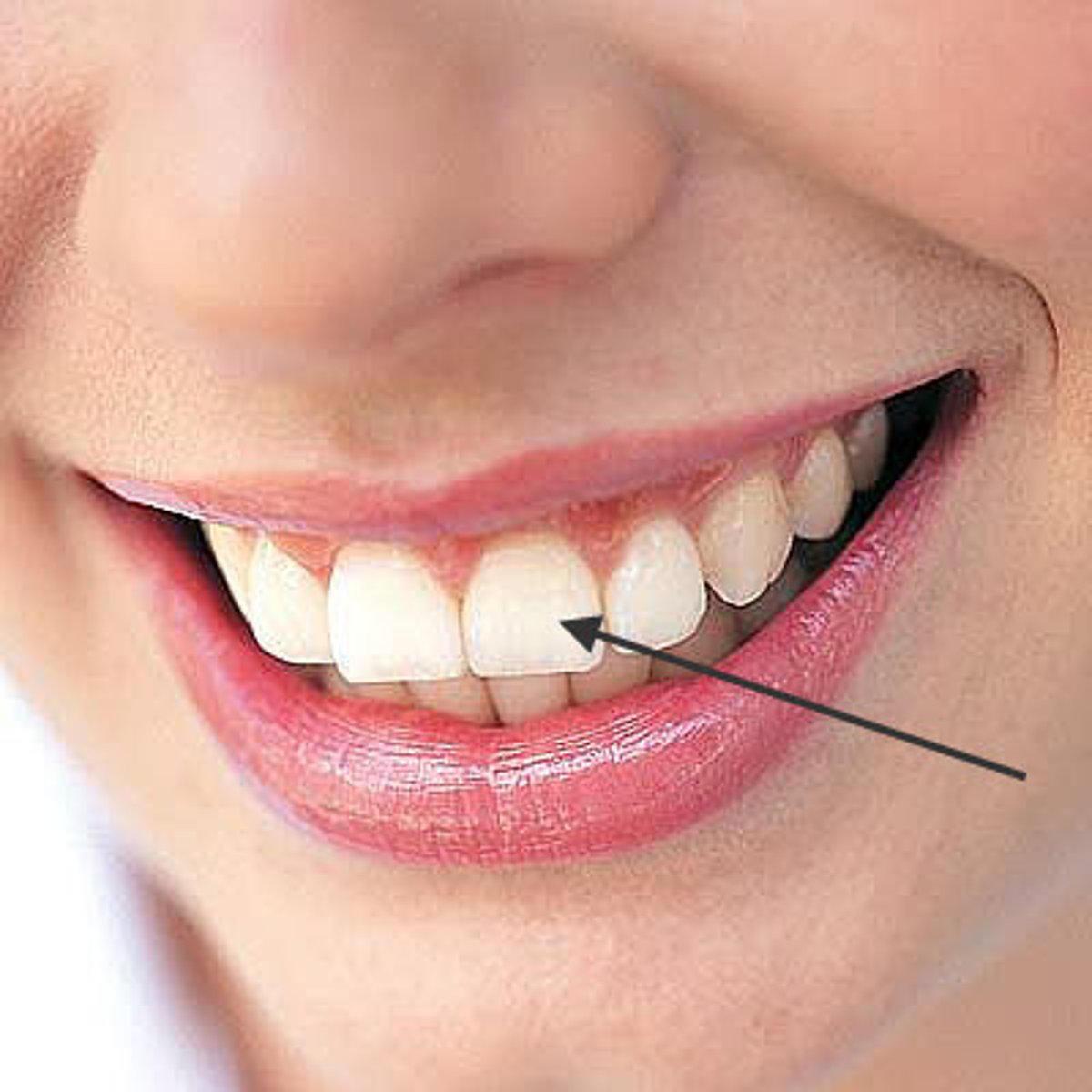 <p>teeth</p>