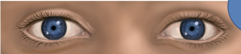 <p>Constricted and Fixed Pupils</p>