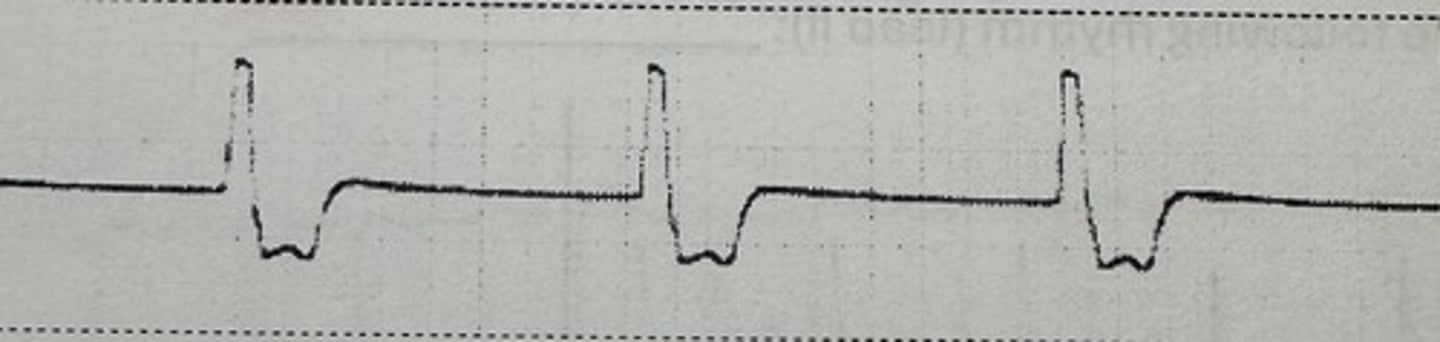 <p>identify the rhythm</p>