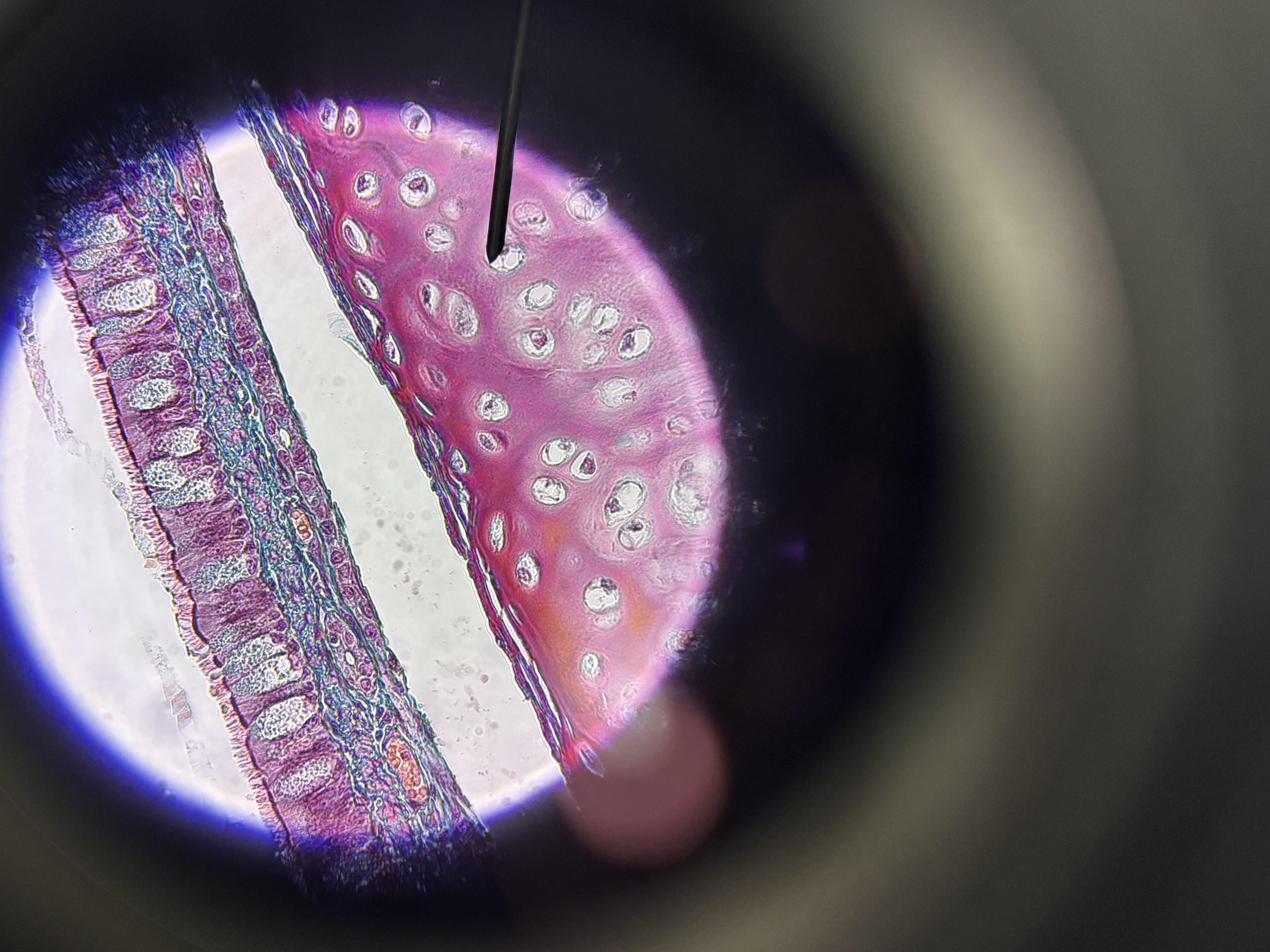 <p>Pseudostratified ciliated columnar epithelium</p>