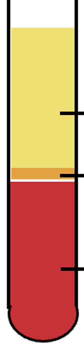 <p>What is in the red section?</p>