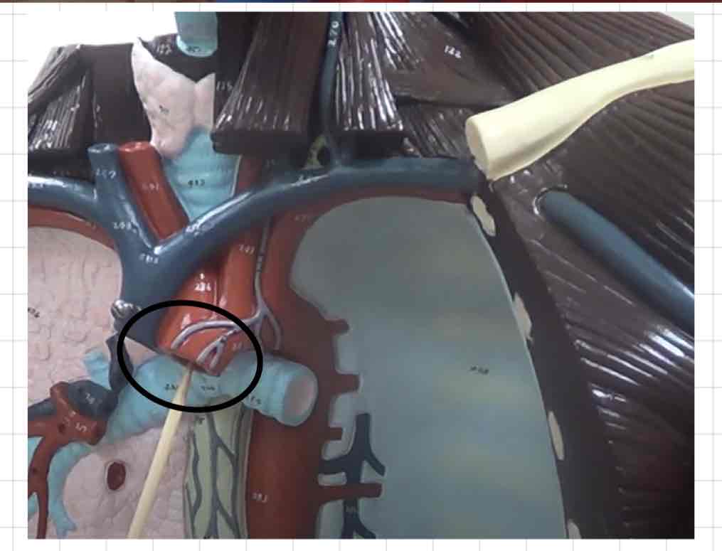 <p>what is this? (torso model)</p>