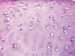 <p>Cartilage that provides support with some flexibility. glassy, smooth appearance.</p><p>-ends of long bone in joint cavities, costal cartilage, nose traces, and larynx</p><p>-Surrounded by perichondrium.</p>