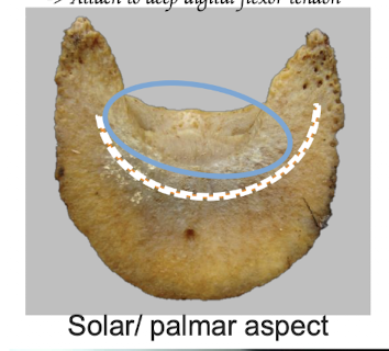 <p>Solar/ palmar aspect of the distal phalanx</p>